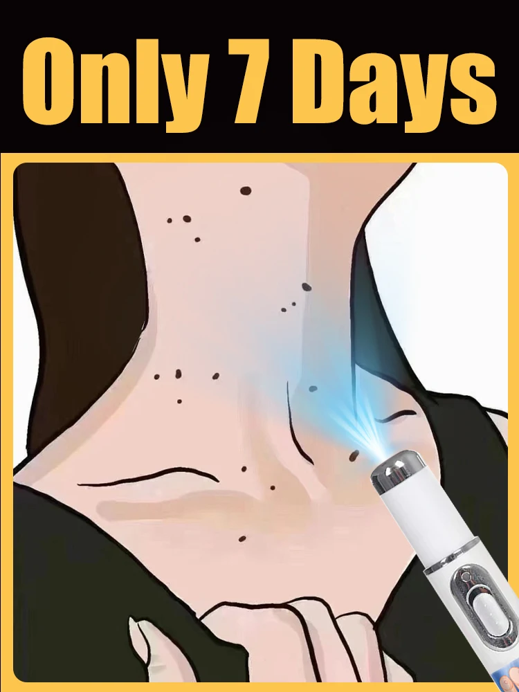 

Blue Light Pen for Wart Daily Care - Gentle Home Tool, Convenient to Use