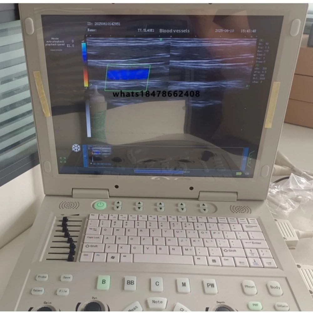Portable Doppler Color Ultrasound Machine Cat Rabbit Horse Livestock Veterinary Detector 1 Year Warranty