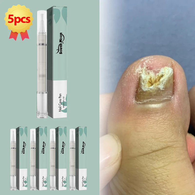 5 Pcs Nail Repair Pen Anti Fungal Nail Ingrown Correction Paronychia Anti Fungus Infection Treatment Cleaner Toenail Care Tool