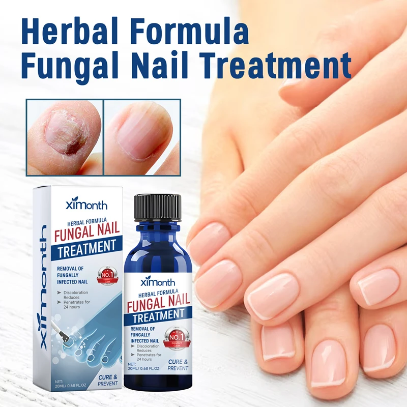 Fungal Nail Care Lotion Nourishing Moisturizing Nail Care Liquid Nail Strengthening Serum Nail Care Product