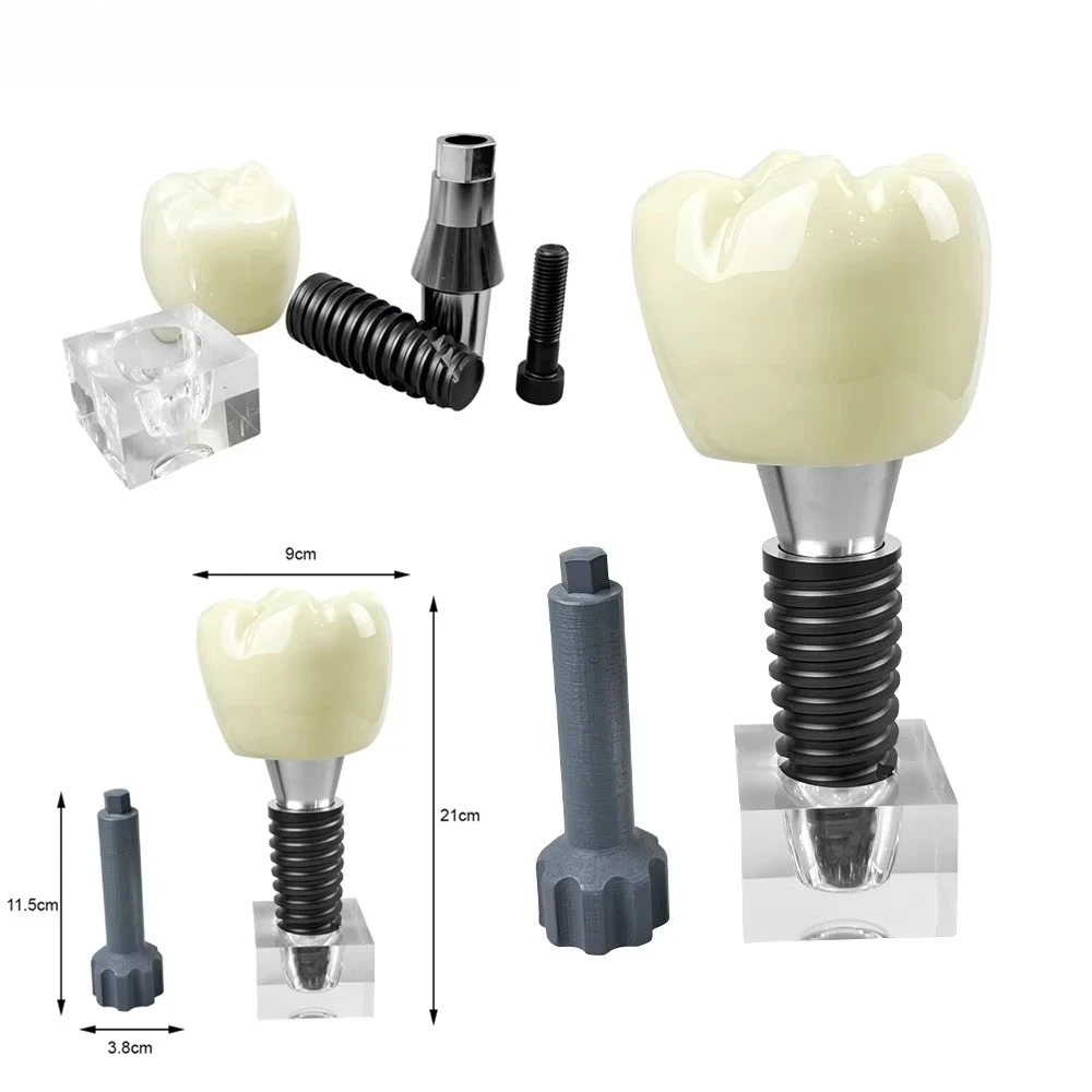Large Single Dental Implant Model Demonstration Dentistry Detachable Crystal Implant Teeth Model For Teaching Education Studying