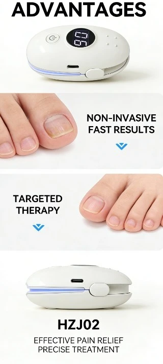 

Портативный лазерный прибор HZJ02 для лечения онихомикоза, 4-волновой лазер для восстановления ногтей на руках и ногах, антигрибковые инструменты