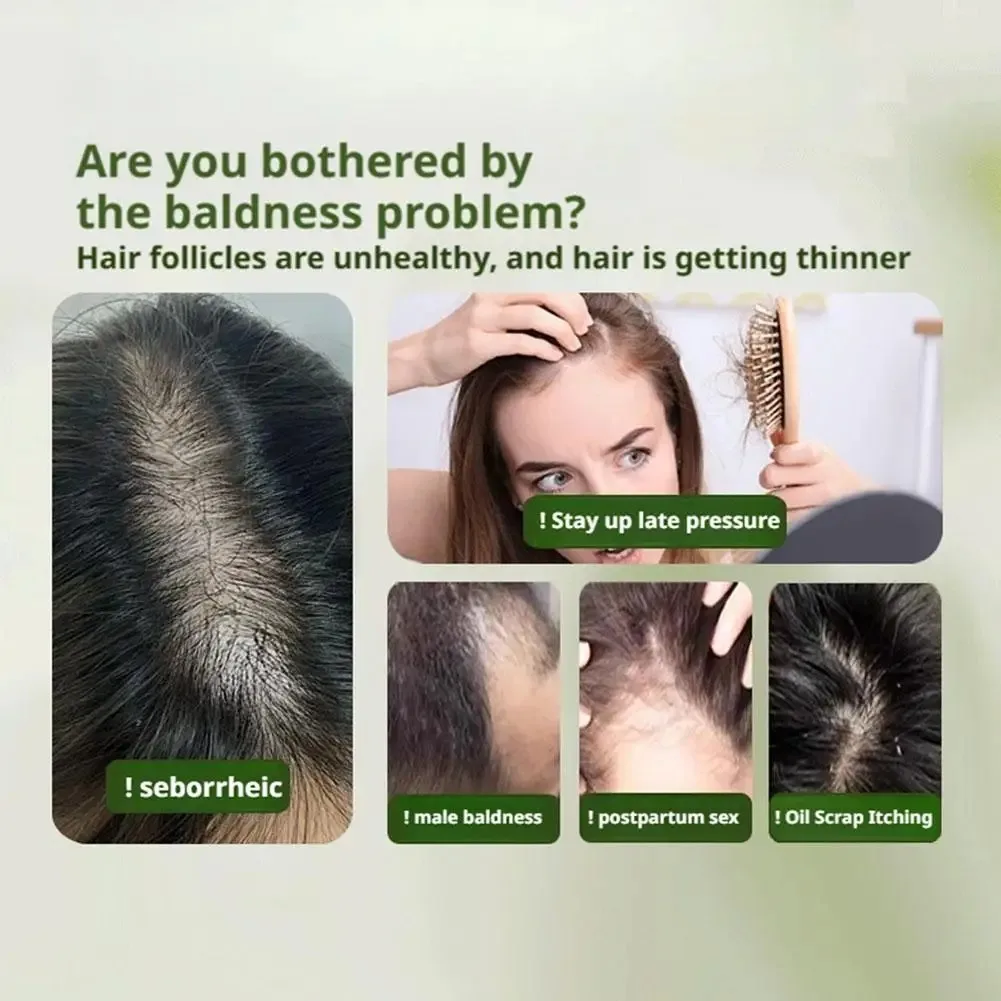 Shampoo per capelli rinforzante alle erbe, sapone shampoo all'estratto di foglie di Biota e Cippress, pulizia profonda, controllo dell'olio, fragranza alle erbe