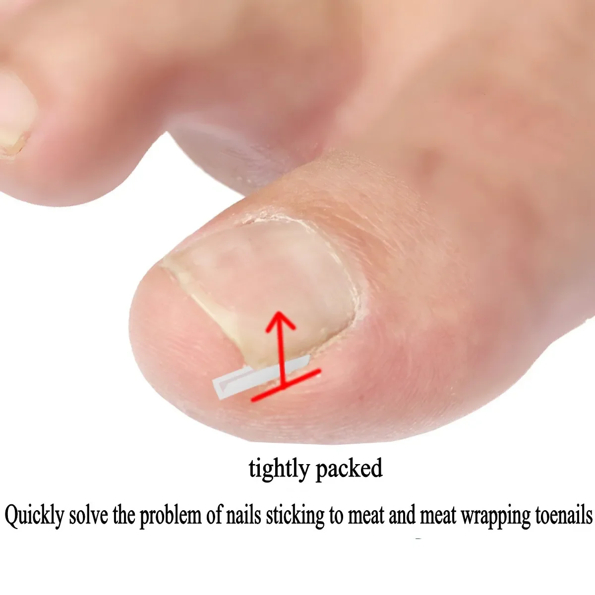 

10pcs/box Ingrown Toenail Correction C-shaped Nail Groove Pads Cuttable Nail Orthopedic Clip Brace Pain Relief Foot Care Tool