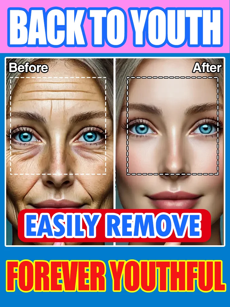 

laser Blue Face Machine aging fine lines skin care