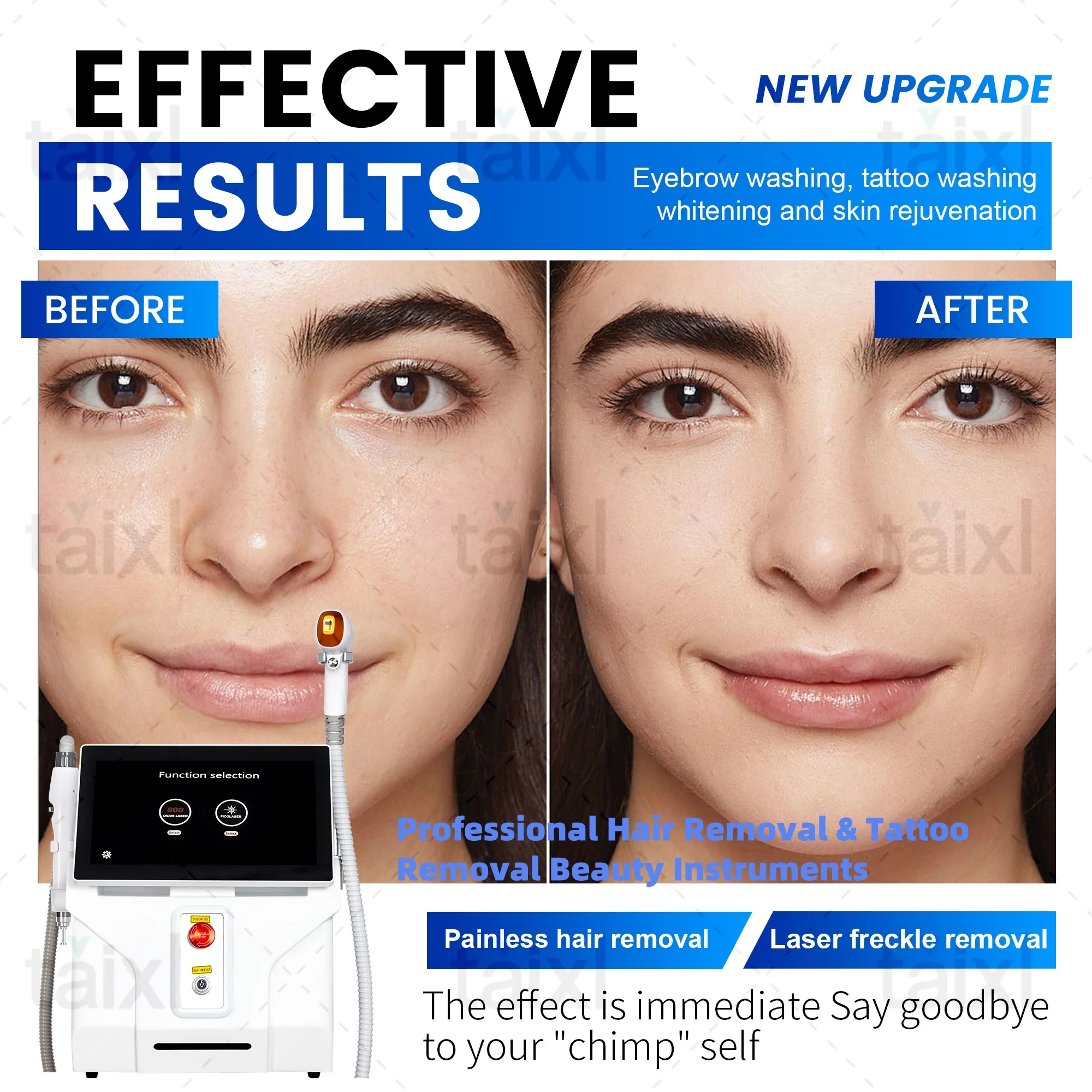 آلة إزالة الشعر بالليزر الدائم غير المؤلمة ذات الصمام الثنائي، آلة تبييض الوشم والنمش