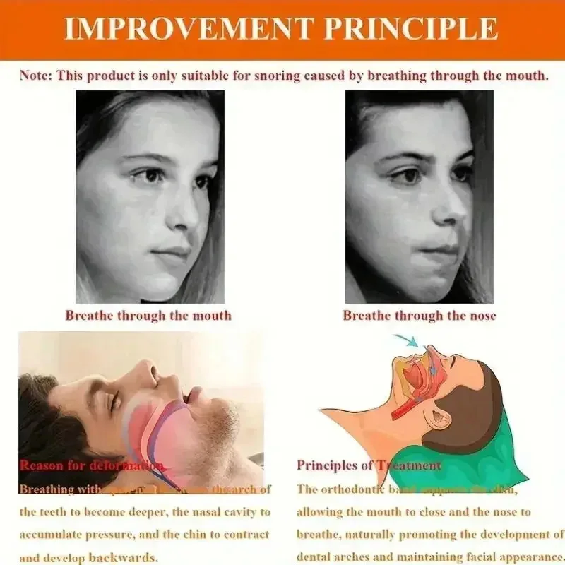 Anti-Snoring Mouth Breathing Correction Band 5