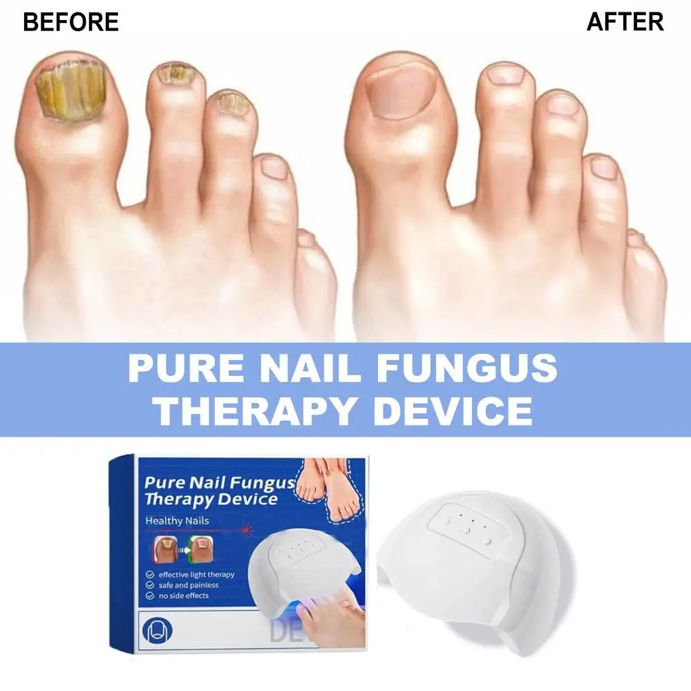 for Toenail Diseases Pure Nail Photo Therapy Device High-Efficiency for Fungal Nail Light Therapy Device Portable Easy to Use