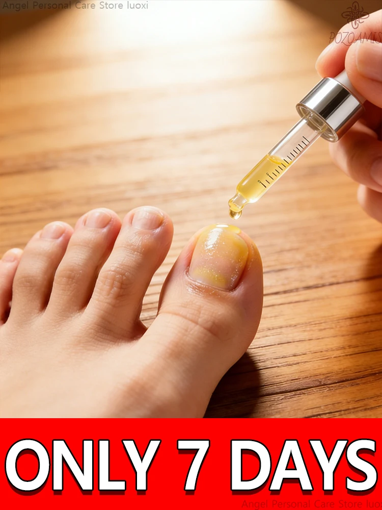 

Улучшает качество типсов для ногтей, смешанные с натуральными растительными экстрактами, которые восстанавливают жизненную силу Neste