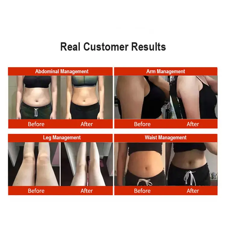 9 in 1 448k Cet Ret Ultrasound Lipo 40k Cavitation Body Shaping Slimming Beauty Machine