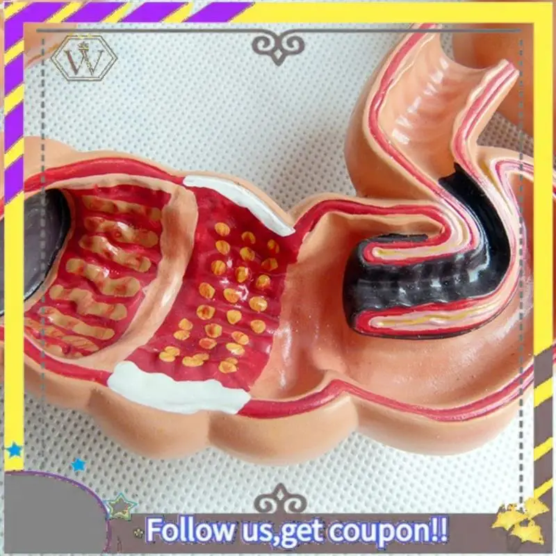 

New Teaching Model,Human Large Intestine Anatomy Model Visceral Lesion Model Human Digestive System Learning Model Easy Install