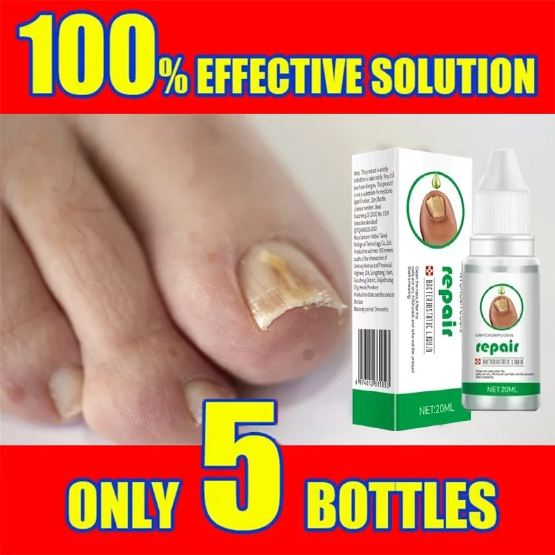 Toenail Nail Fungus Treatment Repair Fingernail Device Toenail Treatment for Foot Nail Fungus Essential Oil Onychomycosis Care