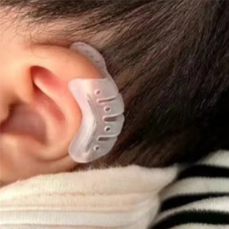 Protruding Ear Support Infant Corrector Auricle Correction Patch Baby Ear Corrector Baby Auricle Valgus Corrector
