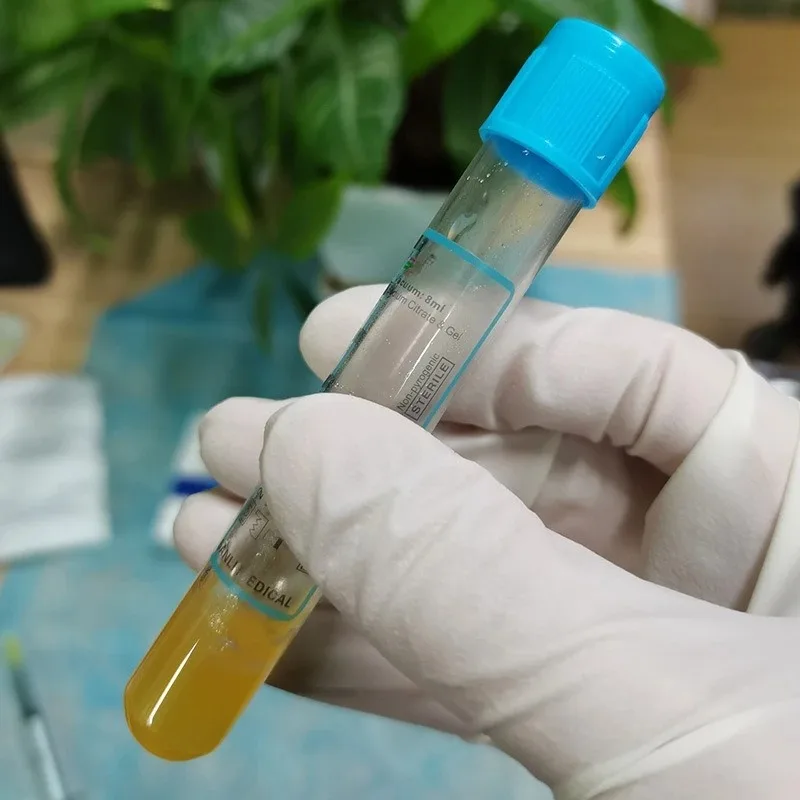 

4pcs Set 8ml Disposable Vacuum Blood Collection Tube,with Sodium Citrate & Seperate Gel Tube Lab Consumables