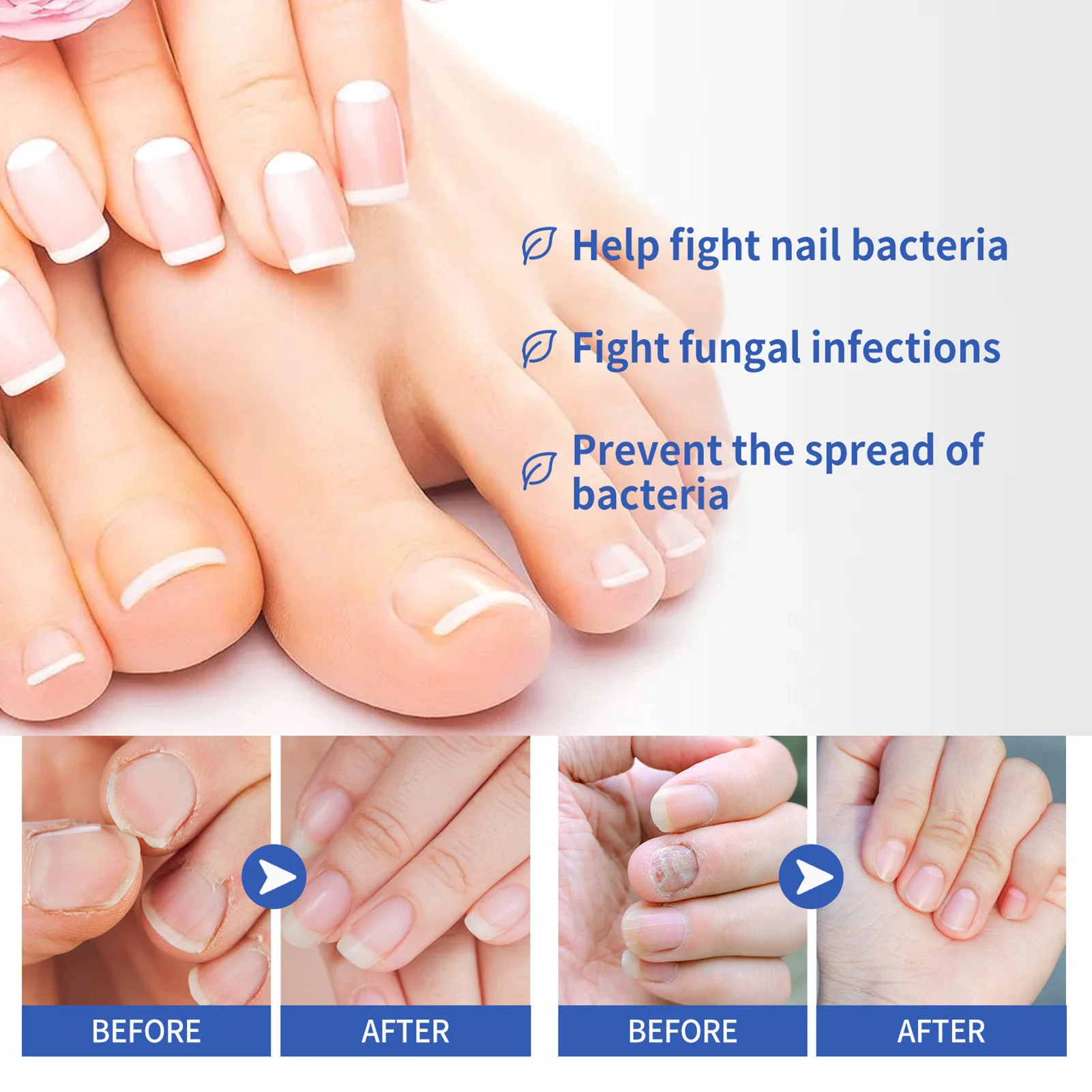 30ml Toenail Treatment Serum Repairing Damaged Nails  for Broken Cracked Split and Weak Nails