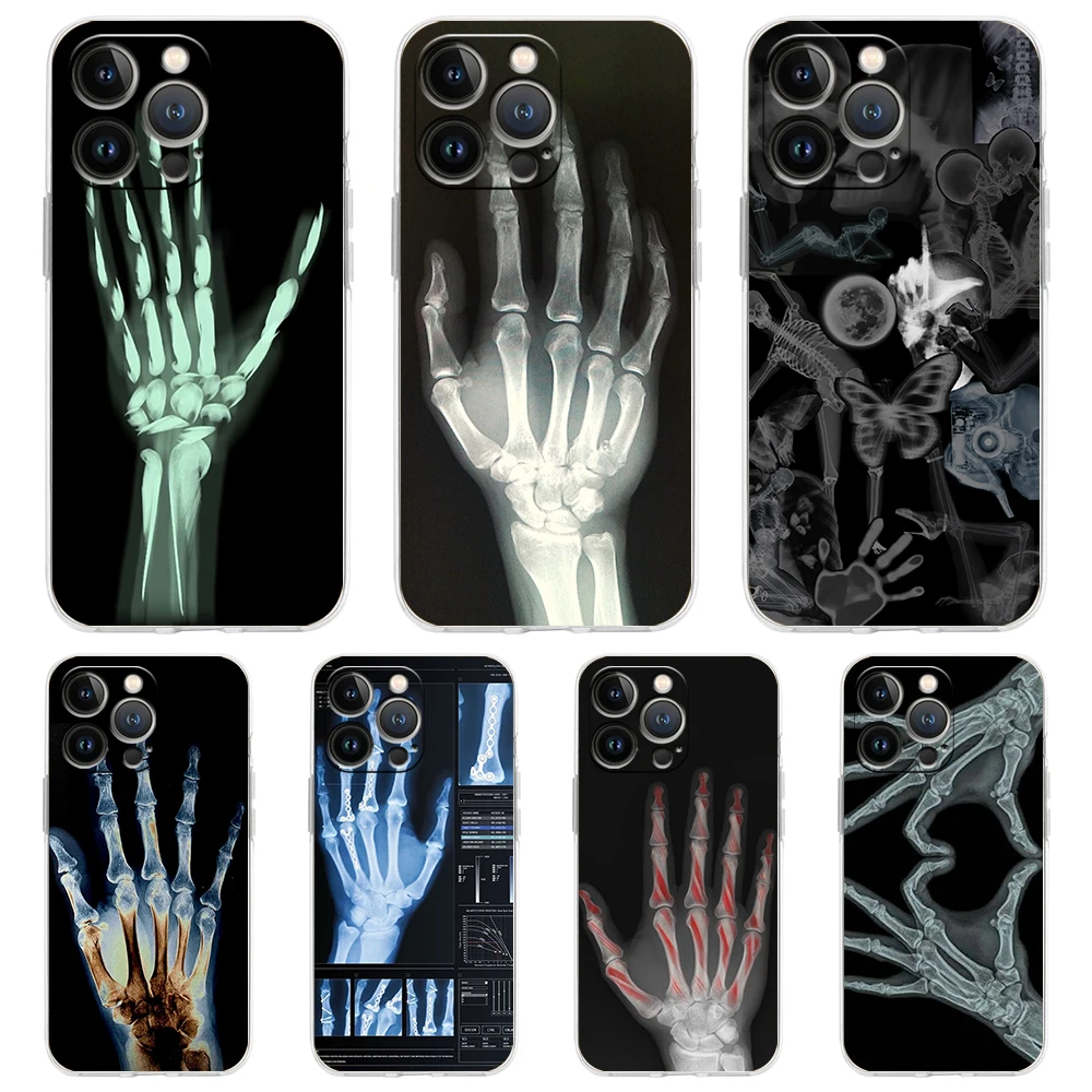 غطاء هاتف شفاف لهاتف iPhone 16,15,14,13,12,11,Pro,Max,8,7,Plus,16E,XS,Max Soft TPU Shell Autumu X Ray حقيبة عظام اليد
