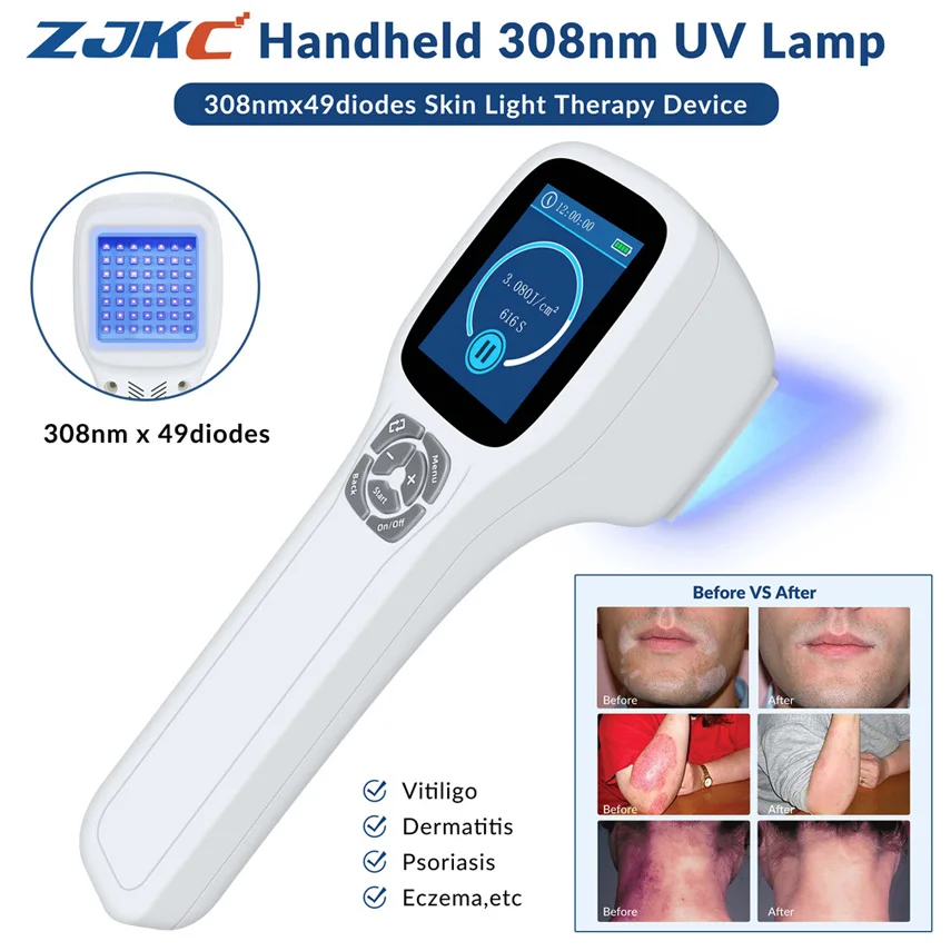 

ZJKC 308nm Excimer System Uvb Home Phototherapy Device for Psoriasis Vitiligo Eczema Skin Diseases Treatment Blue Light Therapy