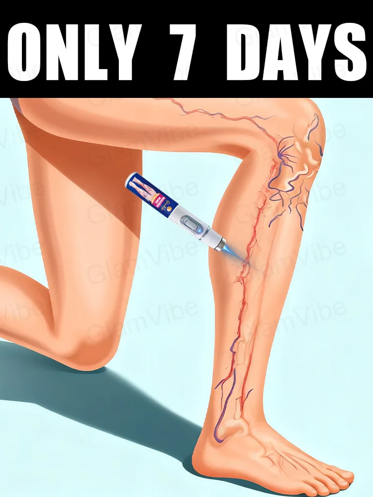 

blue light pen solve varicose veins, hot sale leg care tools