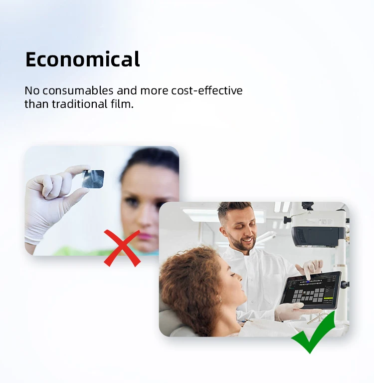 AZDENT Dental-Röntgensensor, digitales intraorales System, HD-Bild-Radiovisiograph, Röntgen-Positionierungs- und Bildgebungssystem für die Zahnmedizin – Detail 10