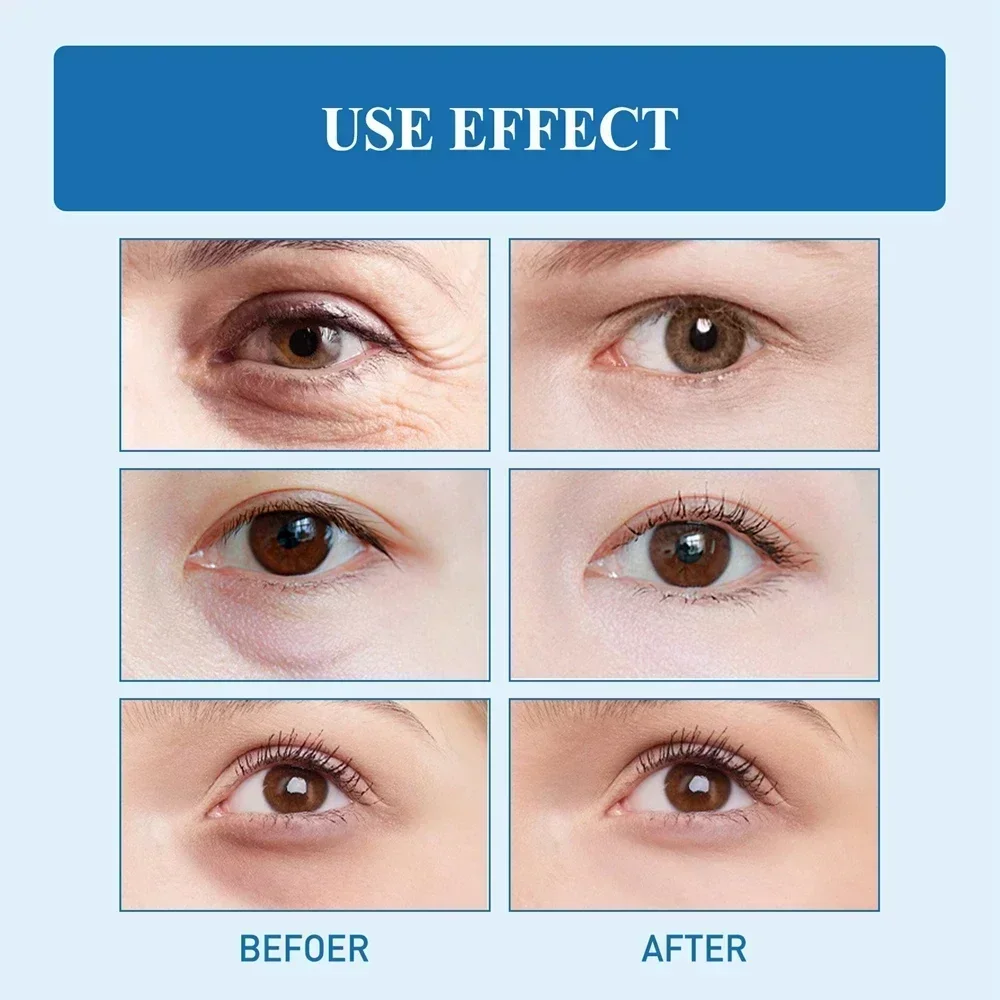 New 7 Day Tighten Wrinkles Eye Cream Anti Dark Circles Bags Puffiness Fade Eye Fine Line Whiten Under Eyes Skin Korean Care