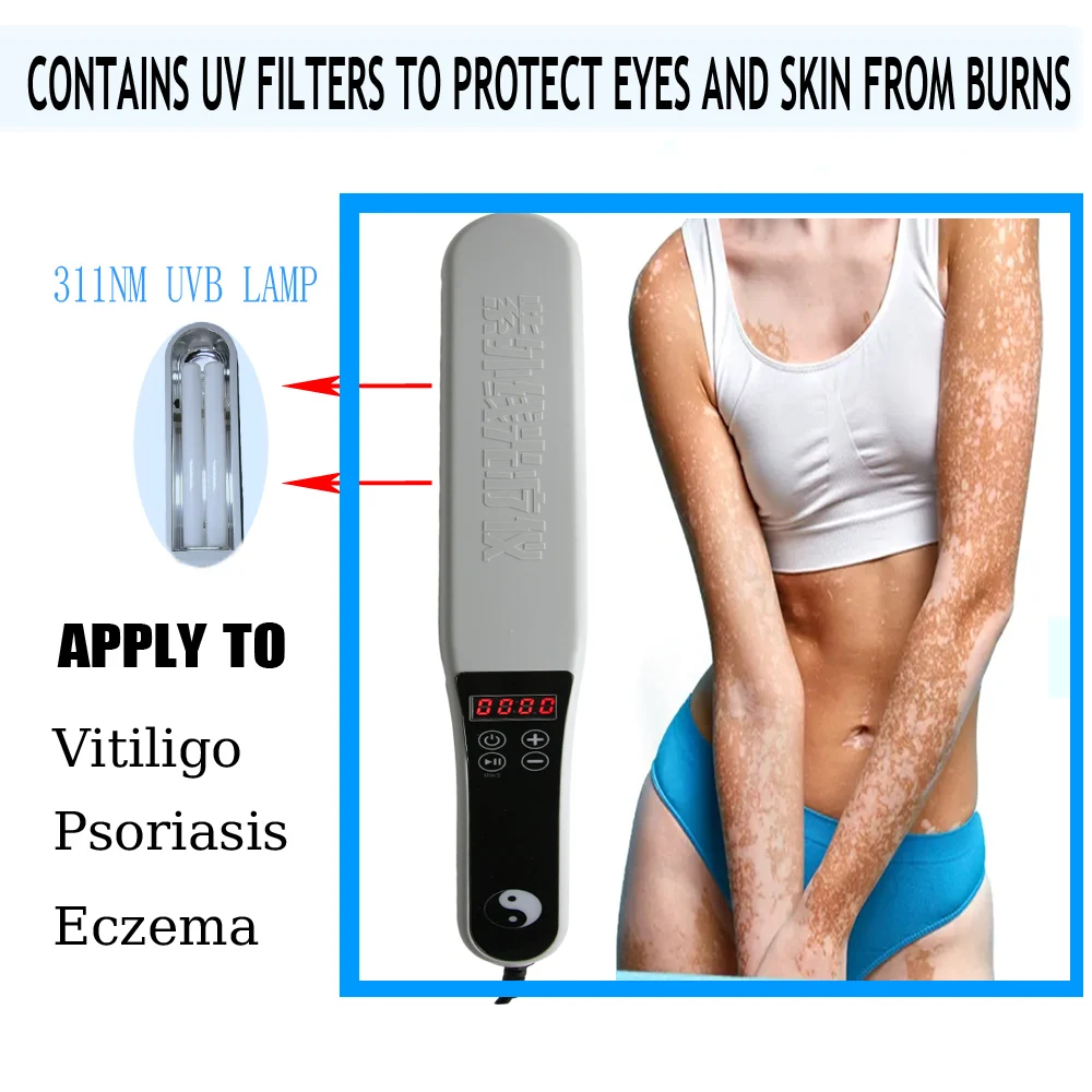 

311-Nanometer Wavelength Ultraviolet Therapy Device, Used For Treating Vitiligo And Psoriasis. Adjustable Duration