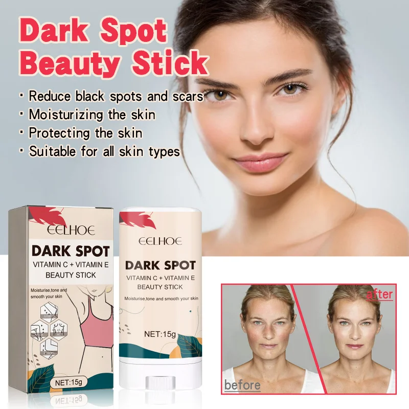

Dark Spot Correcting Stick 15g - Helps Brighten & Even Skin Tone, Moisturizes Elbows/Knees, Portable & Easy To Use