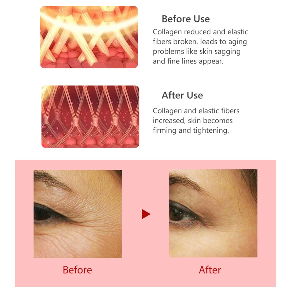 dtew-–-appareil-de-massage-des-yeux-a-radiofrequence-stylo-anti-rides-traitement-par-radiofrequence-therapie-par-lumiere-rouge-appareil-facial-portable-pour-les-soins-de-beaute