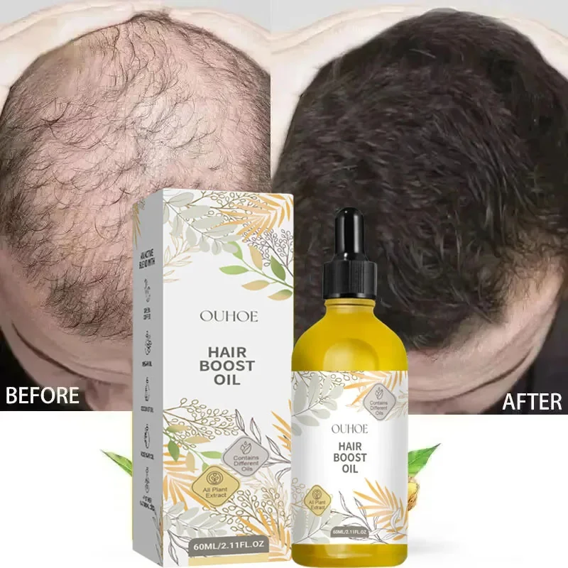 

Rosemary Oil Hair Growth Products for Man Women Ginger Anti Hair Loss Fast Regrowth Thicken Oils Scalp Treatment Hair Care 60ml