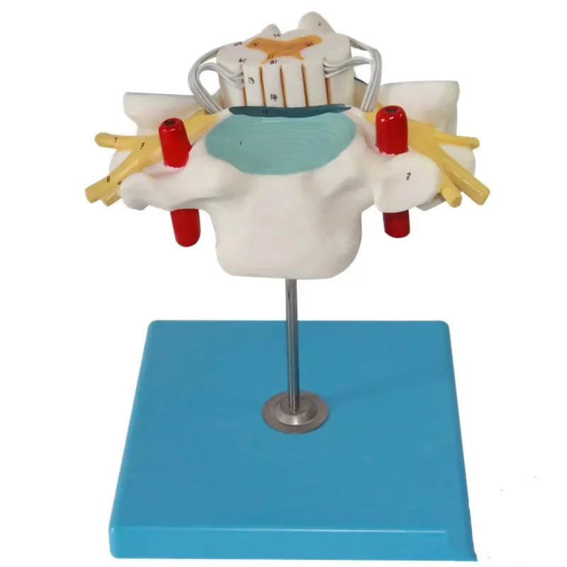 Medical human cervical spinal cord and spinal cord nerve enlargement anatomical model
