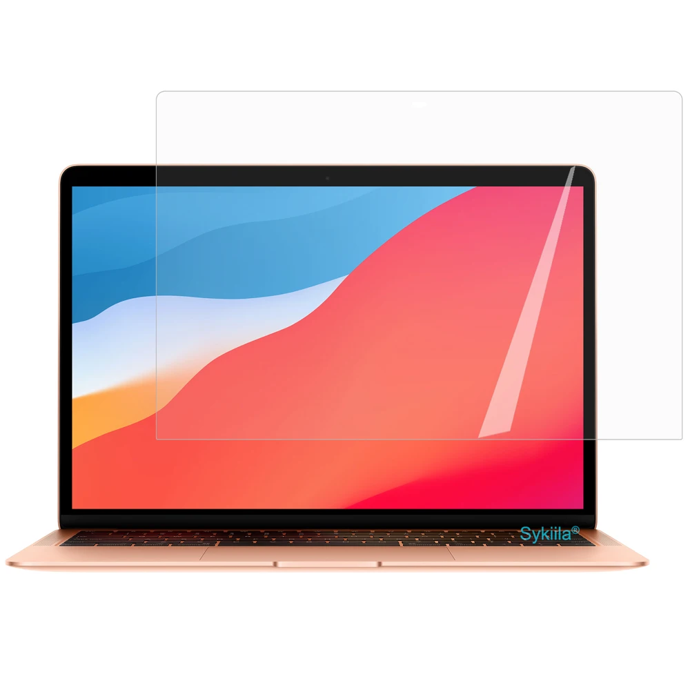 Case for Macbook Pro 16 Pro 13 M1 14 15 Touch Bar Air M2 11 12 Retina Hard Shell Printed Laptop Cover A2485 A2141 A2289 A1932