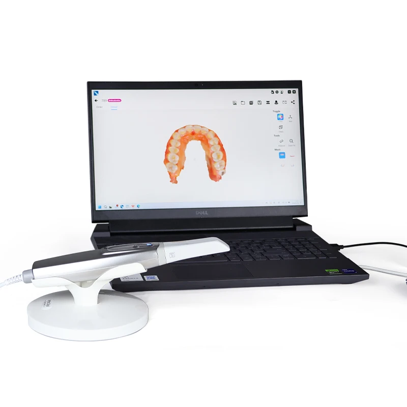 3D Digital S3 Intraoral Scanner Al Scan System X-Rays Scanner HD Camera Portable Dental Unit Fast Imaging Ture Color