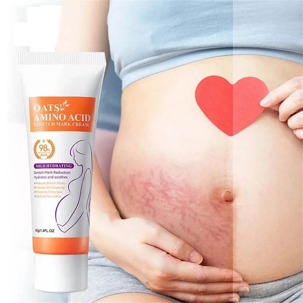 

Stretch Mark Removal Cream Removes Stretch Marks Permanently Anti-Wrinkle Rejuvenates Skin