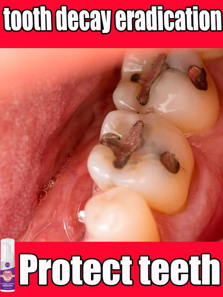 tooth decay repair cavities protect teeth