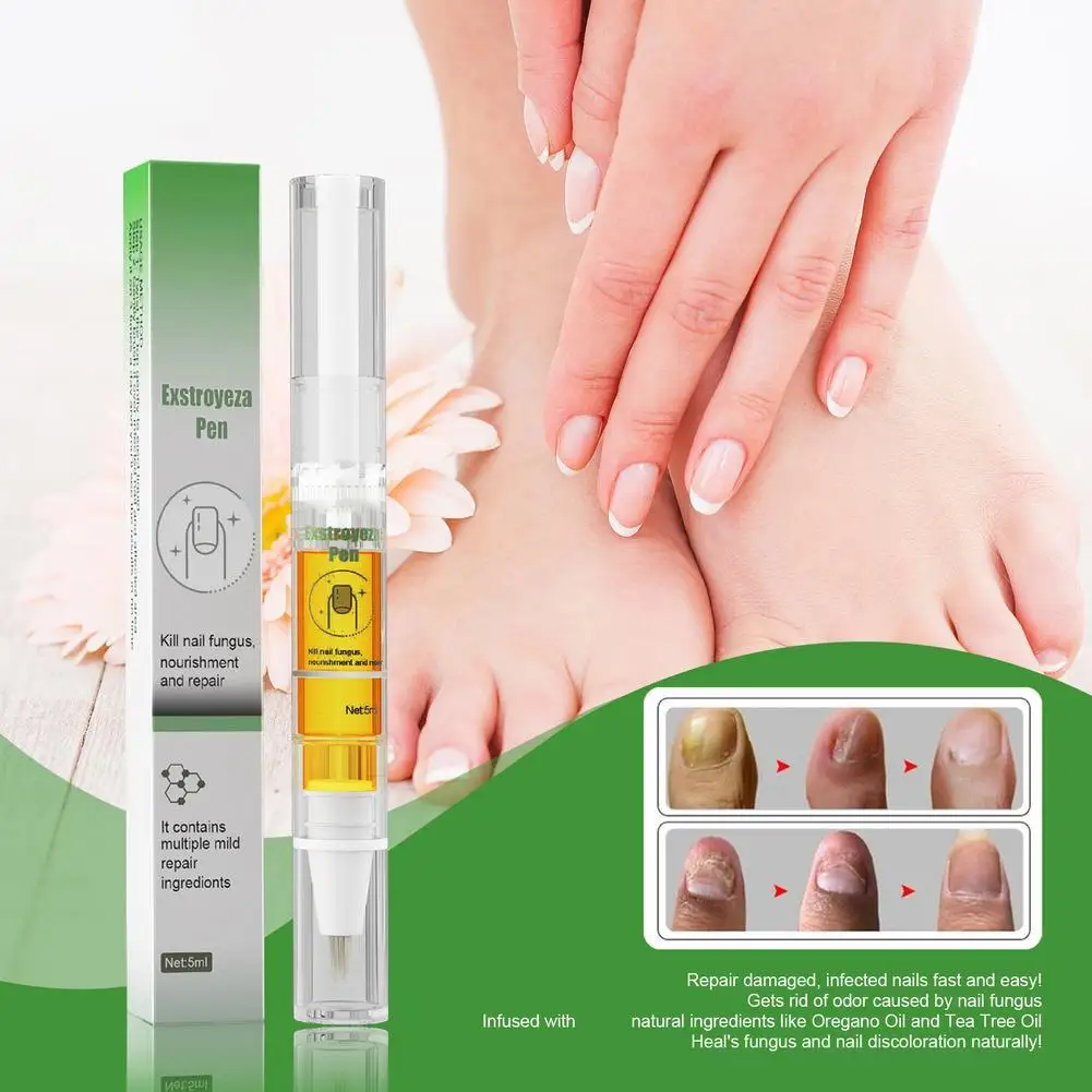 

5ml Nail Fungus Repair Pen Remove Onychomycosis Paronychia Reduce Toe Infection Brighten Nail Hand Foot Nail Care Liquid
