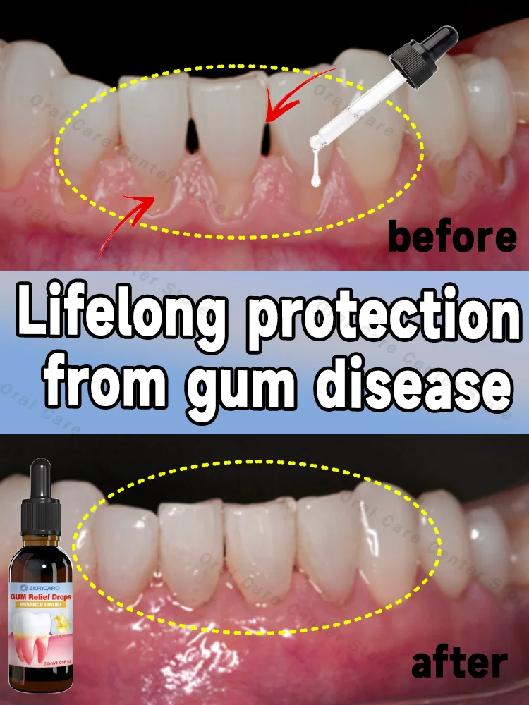 Effectively repair damaged gums, relieve toothache, repair bleeding gums, strengthen teeth and firm gums