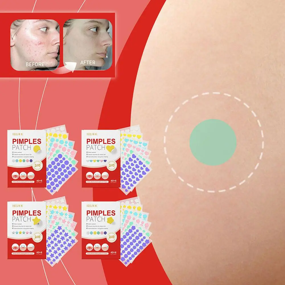 

240 Patches Acne Patch Gentle Non-irritating Repair Pimples Residue-Free Cleansing Deep Covering Invisible Blemish Facial P H3L6