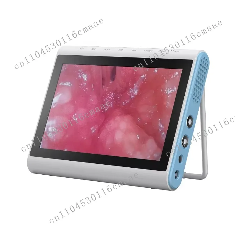 Single Use Digital Flexible Uretero-Renoscope with 10 Inch Display HD Camera Electric Power Source for Operating
