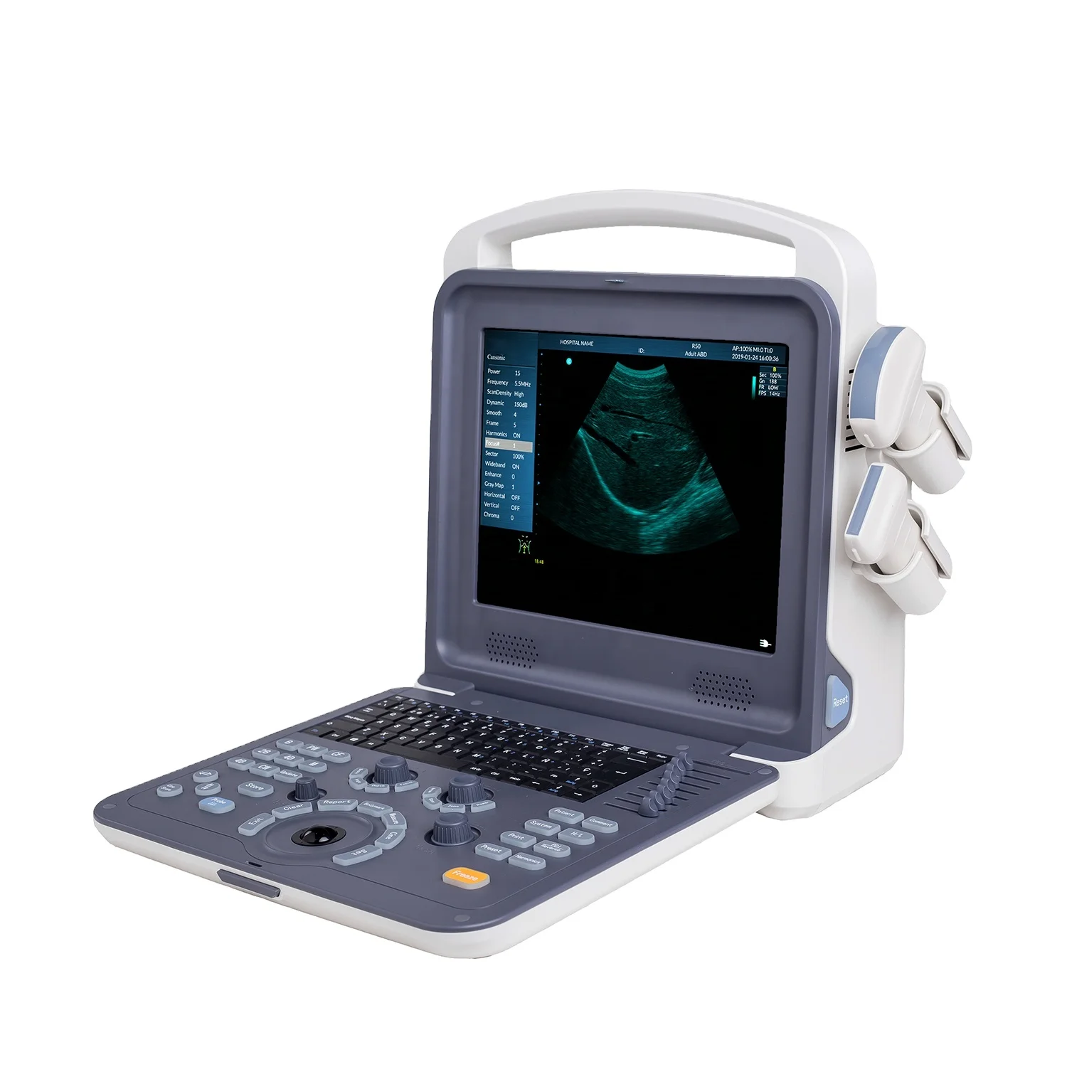 SZMIQU Clinic Portable 12 inch LED Color Doppler Full Digital Ultrasound Scanner Diagnostic with CE/ISO Certificate