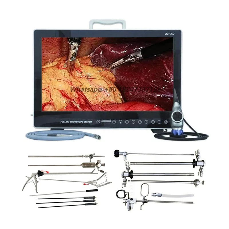 SY-PS050 Veterinary medical portable endoscope imaging system integrated machine endoscope high definition