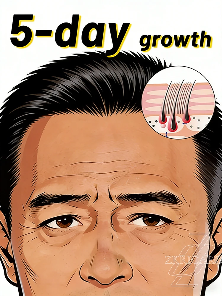 

2026 Нежный спрей для ухода за кожей головы — богатая формула — укрепляет тонкие волосы