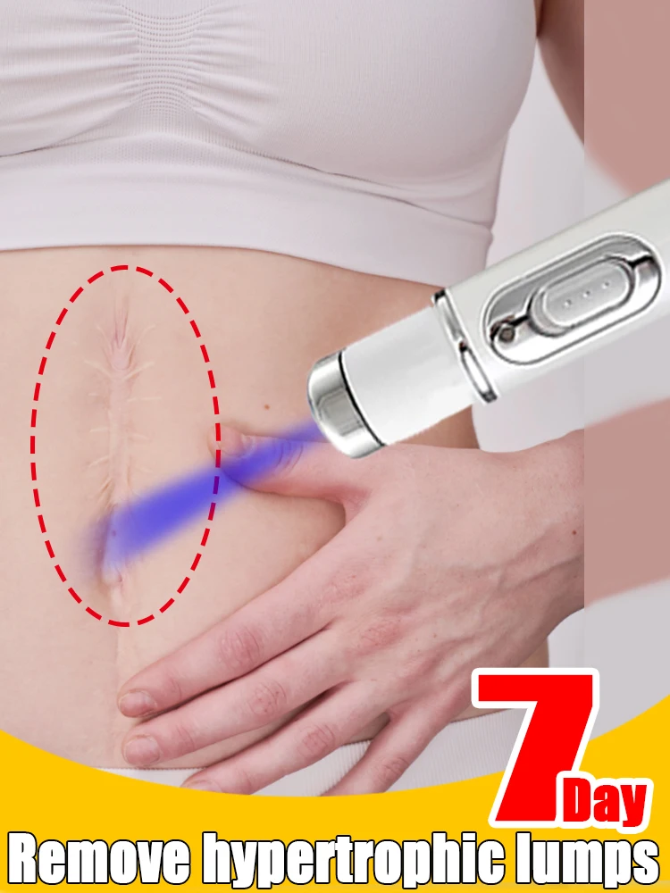 

Laser scar removal effectively repairs old scars, surgical scars, pregnancy scars, acne scars, burn scars