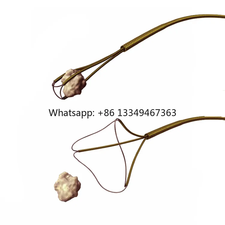 Manual Flexible Nitinol Basket Disposable for Urology Stone Retrieval Extraction Nitinol Stone Engagement