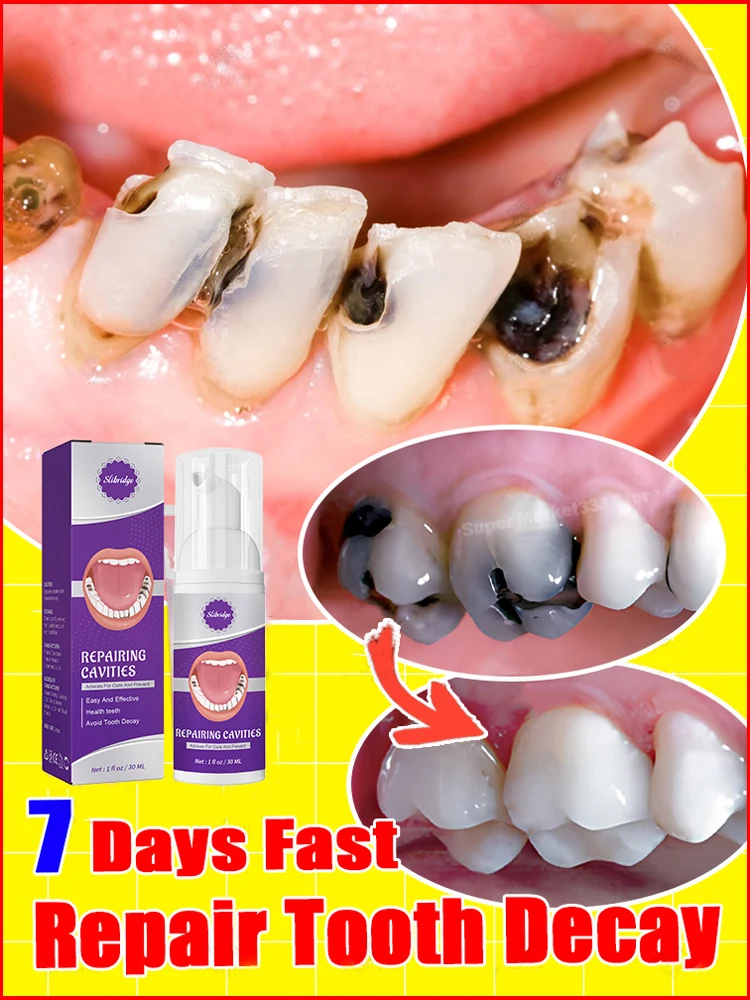 tooth decay repair