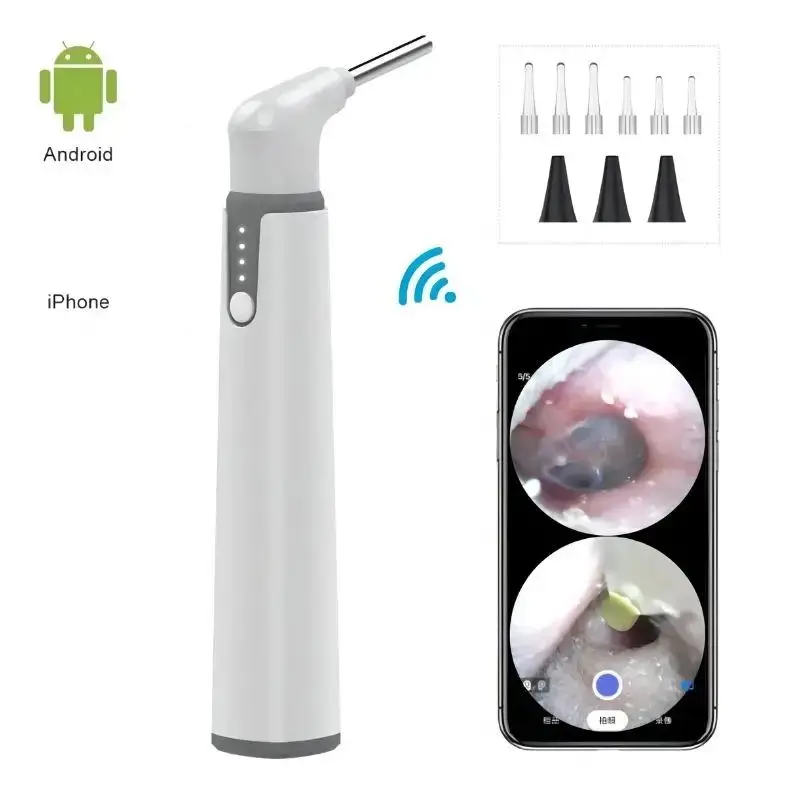 

Ear Scope Camera with Dual View Wifi Digital Otoscope 3.9mm 720P with 6 LED Lights for Kids and Pets work with IOS Android