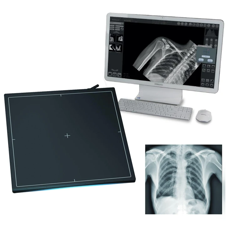 Best Price 17*17 Wireless Portable Flat Panel X Ray Detector Dr Flat Panel Detector Flat Panel Detector Veterinary