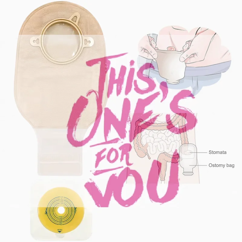 

Одноразовые колостомные мешки, принадлежности для стомы, двухкомпонентные дренируемые мешки с кольцом для стомы, уход за стомой