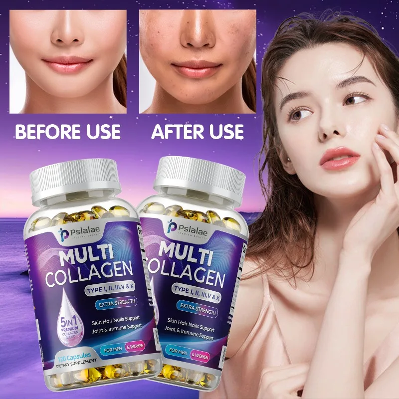 

Несколько коллагеновых капсул — антиоксидант, поддерживает здоровые волосы, кожу и ногти, улучшает пищеварение.