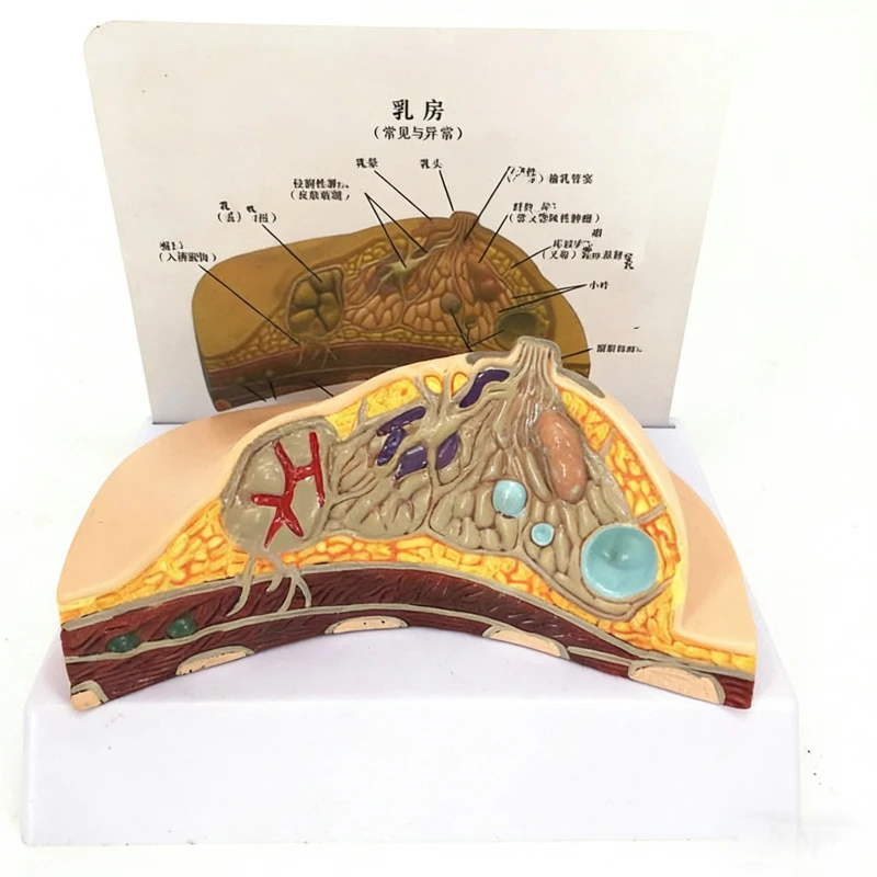 

Модель патологии груди, комплект средней части человеческого тела в натуральную величину, медицинский обучающий инструмент для анатомии грудного воздуховода