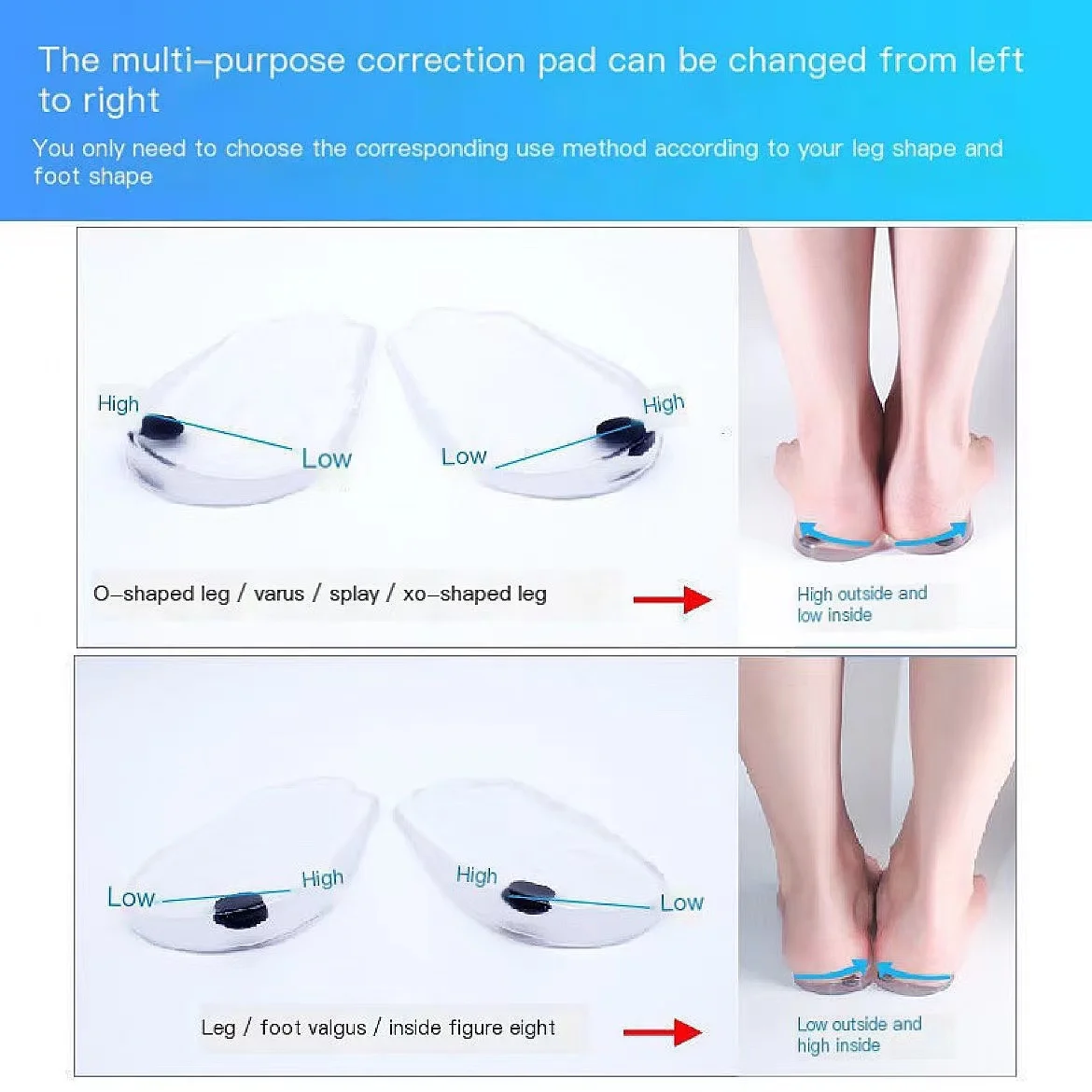 X/ O-shaped Leg Correction Insole Inside Eight Figure Outside Eight Straighten Healthy Beautiful Legs Correct Looped Legs