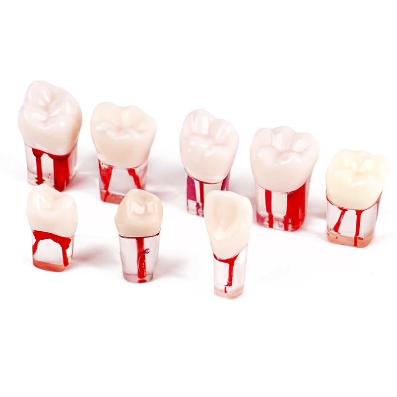 Modèle de canal radiculaire dentaire, dents endodontiques, sorties d\'entraînement, RCT, étudiant, dentiste, fuchsia, 5 pièces